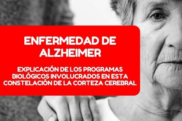 alzheimer-demencias