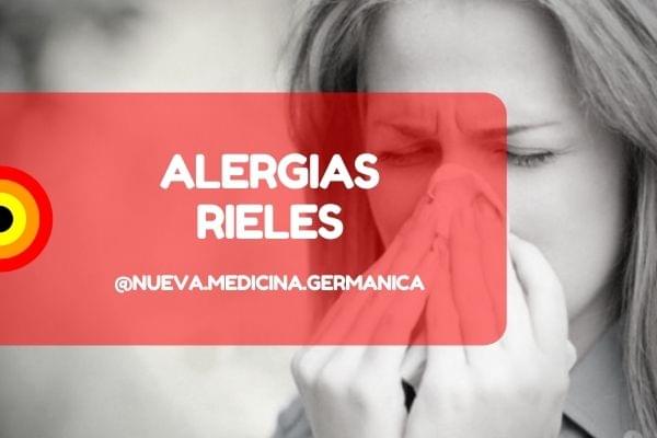 alergias y rieles