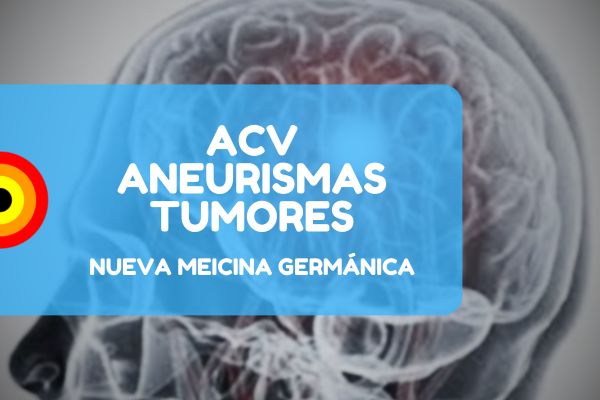 Acv Aneurismas Nueva Medicina Nmg